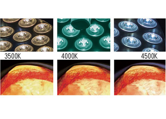 90VA 그림자 없는 작동 LED 수술 램프 직경 65cm 160000 LUX